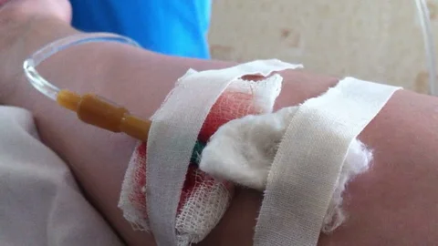 Check Intravascular